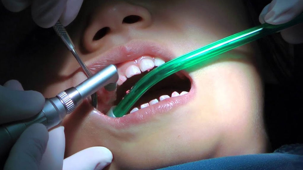 بیشترین درد مربوط به کدام خدمات دندانپزشکی است؟